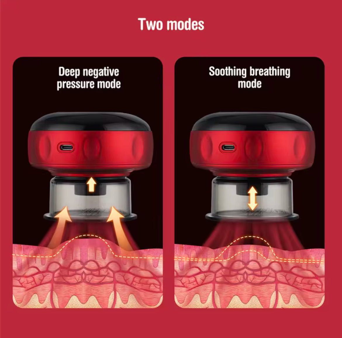 Intelligent Breathing Cupping Massage Instrument